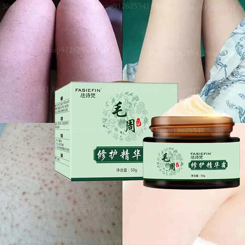 50g Hair Follicle Keratosis Cream Chicken Skin Repair Cream Body Lotion Moisturizing Nourishing Skin Care Essence Whitening Body