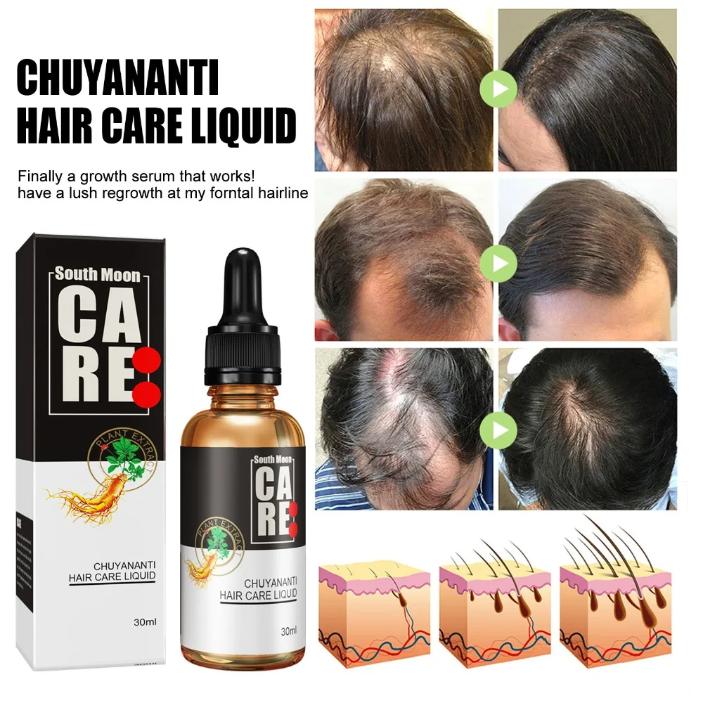 Hair Growth Essential Oil Nourishing Hair Root Fast Growth Anti-Drop Hair Care Nutrient Solution