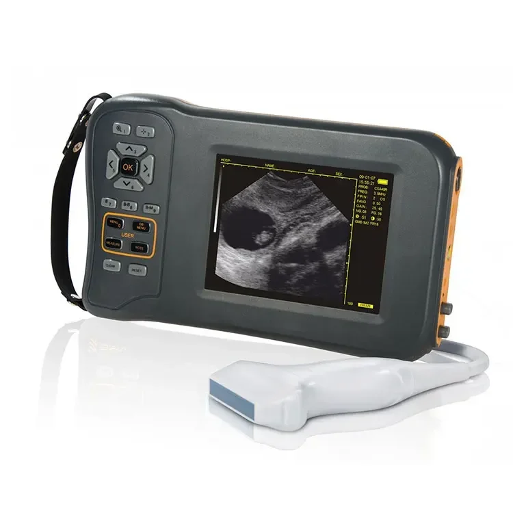 Animal/vet Ultrasound Scanner & Mini Veterinary Ultrasound Diagnostic Machine Equipment Price