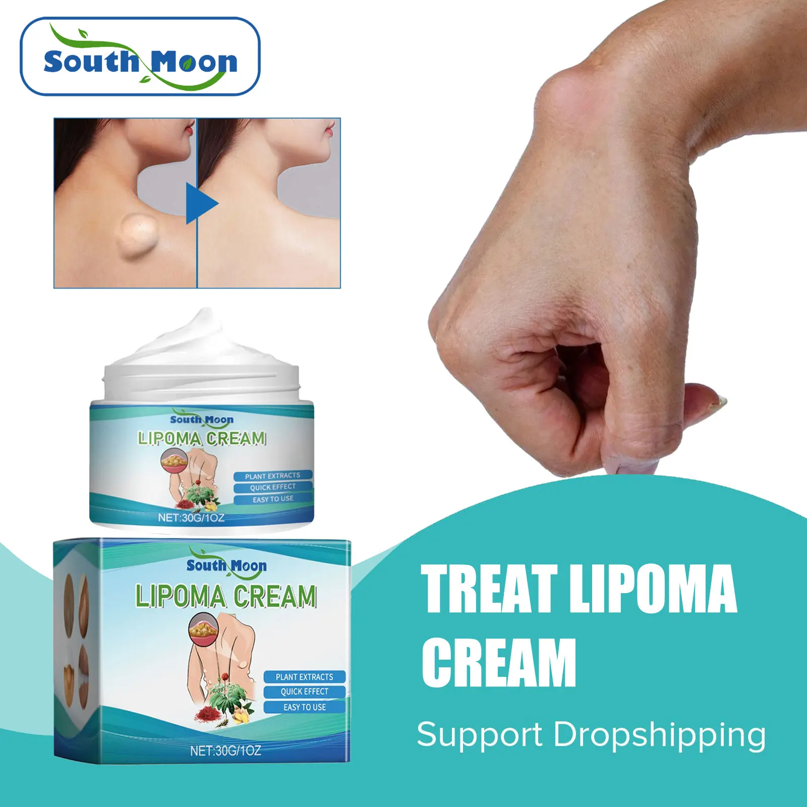 South Moon Lipoma Treatment Cream Lymph Nodes Removal Neck Armpit Swollen Pain Relief Anti Inflammation Lymphatic Detox Cream