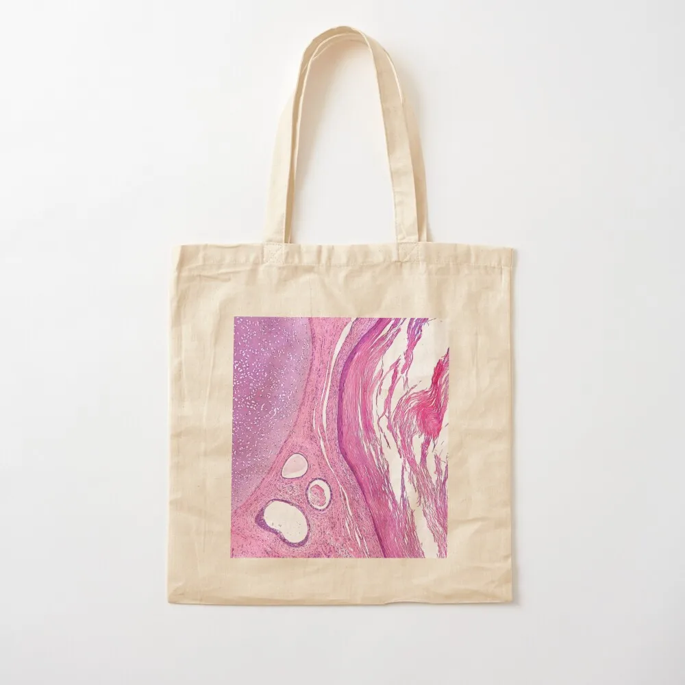 

Teratoma Histology Tote Bag Women's shopping bag reusable grocery bags eco bag folding Canvas Tote