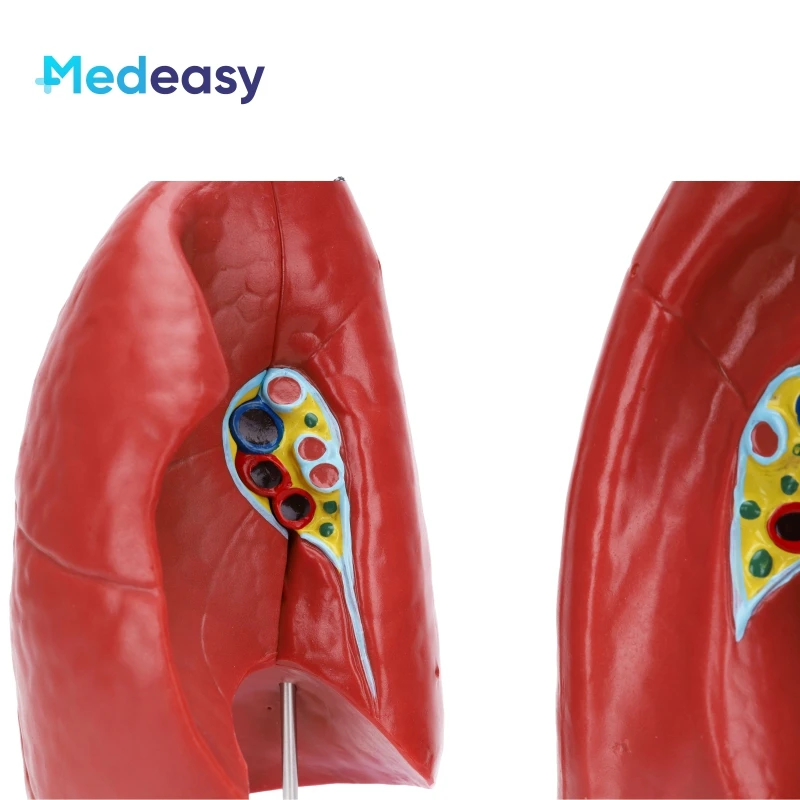 Detachable Human Anatomy Lung Anatomical Model