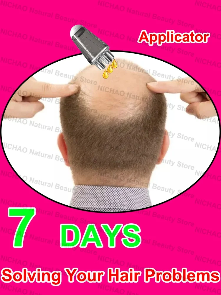

7 Days Fast Hair Growth Essential Loss Regrowth Treatment Strengthens Hair Nourishes Scalp Light Weight Non Greasy