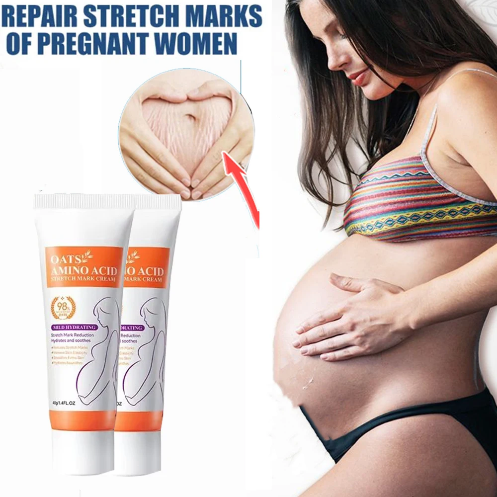 

Stretch Marks Permanent Removal Cream Eliminate Body Belly Stretch Marks Swelling Marks Remove Skin Cracks Repair Firming Care