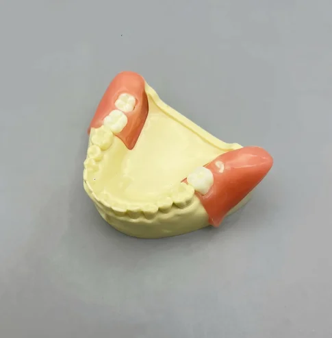 Dental Impaired Tooth Extraction Practice Model Dental Replaceable Impaired Tooth Wisdom Teeth Practice Model