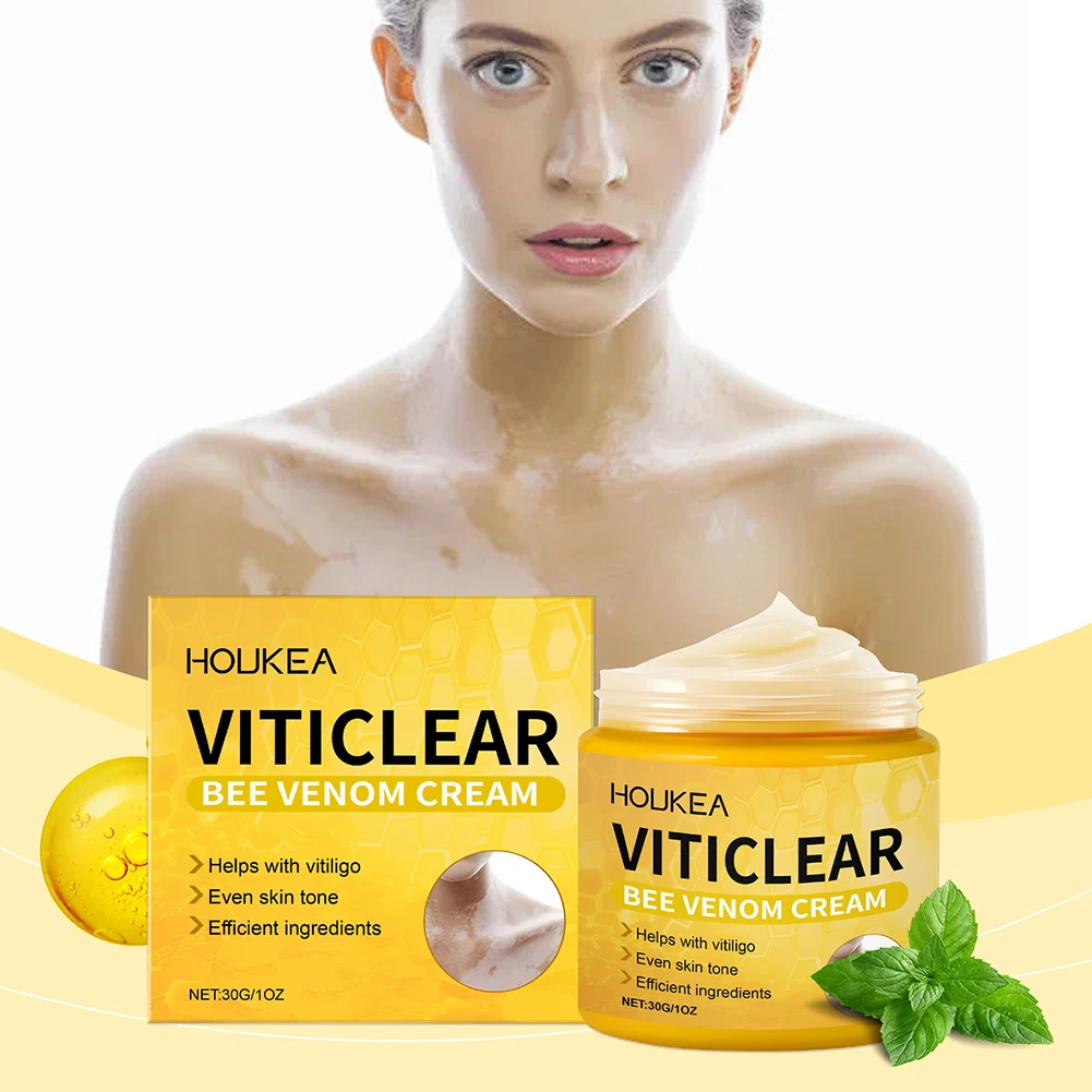 Portable Beevenom Anti Vitiligo Treatments Cream for Leucoderma White Patch Discoloration of Skin Anti-itch Body Care Cream ﻿