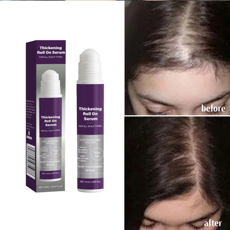 

Сыворотка для увеличения объема, шариковая сыворотка, увлажняющая, фиксирующая влагу, уход за кожей головы, вода, масло, баланс, уход за кожей головы, брендовое лечение волос