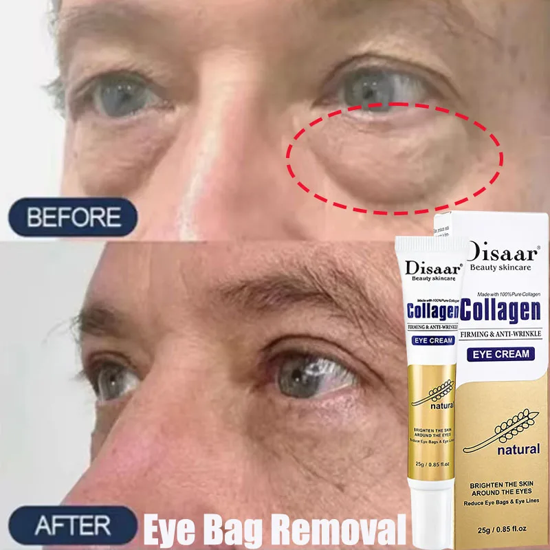 

Instant Eye Bag Removal Cream Collagen Anti-Wrinkle Fade Fine Lines Firming Skin Anti Dark Circle Puffiness Brighten Eye Care