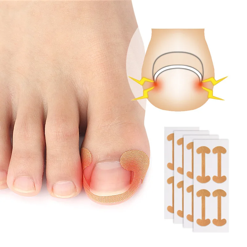 Parche 4/10/12 pegatinas para uñas que mejoran la elasticidad de la uña encarnada, parche corrector de uñas autoadhesivo, parche Corrector de uñas de los pies integrado