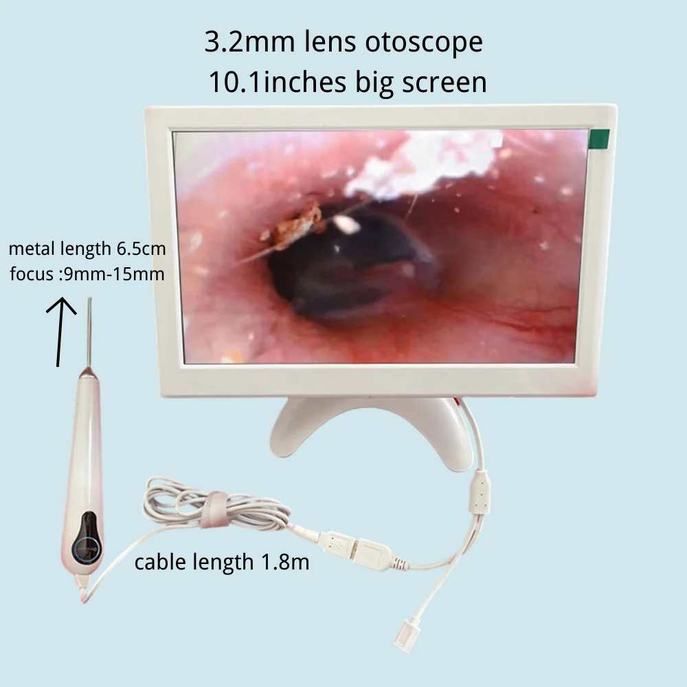 Visible Light Ear Spoon 10.1 inch Large Screen HD 3.2mm Thin Lens Ear Cleaner Tools with 6LEDs Endoscope Ear 3500mAh