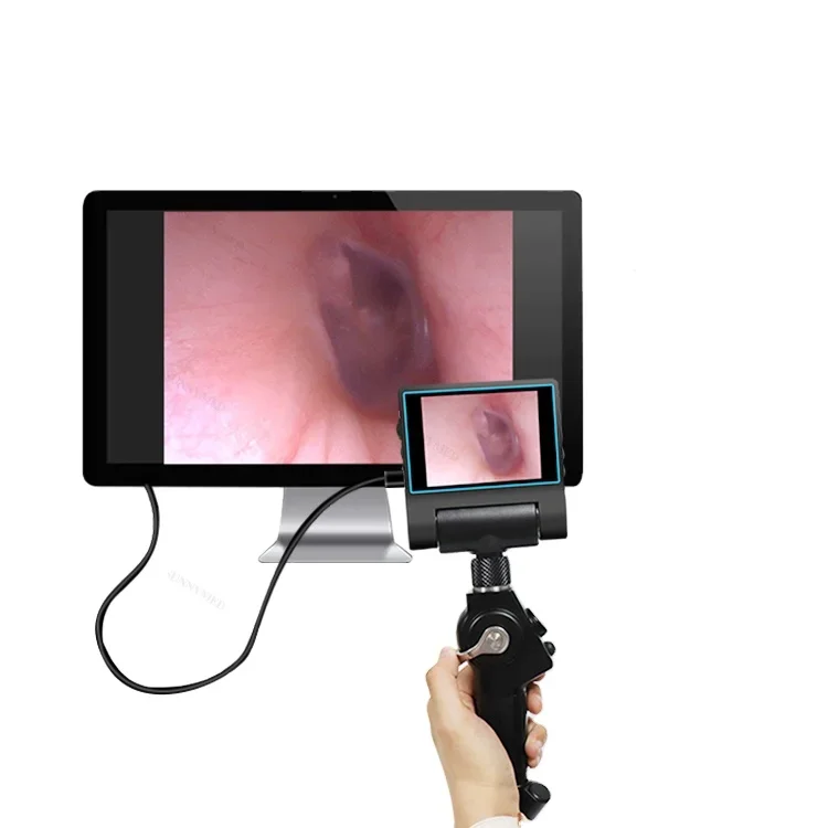 SY-P029-1 Portable handheld video endoscope 2.8mm diameter ENT/urological endoscope