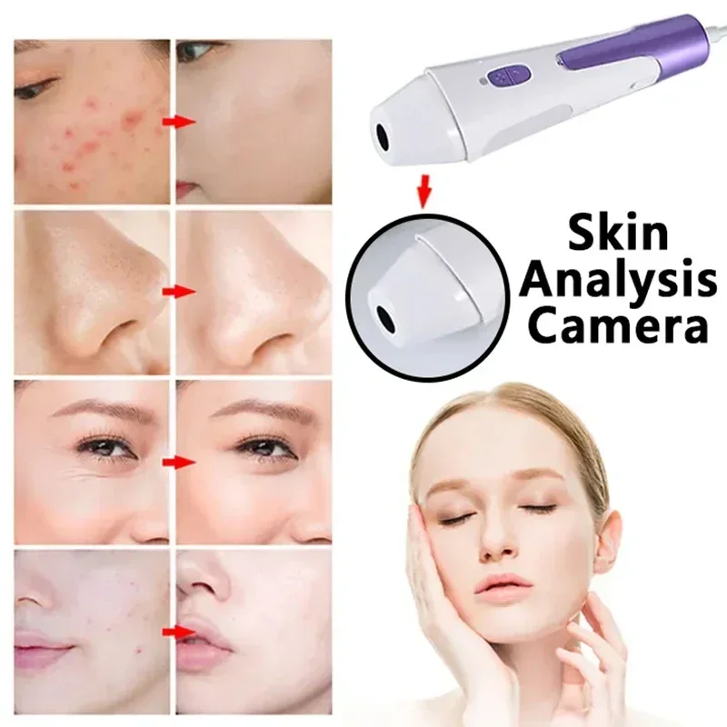 New Design 4 In 1 super  Jet Facial Machine  Ultrasonic  Care CO2  Bubble Exfoliate  Facial Machine