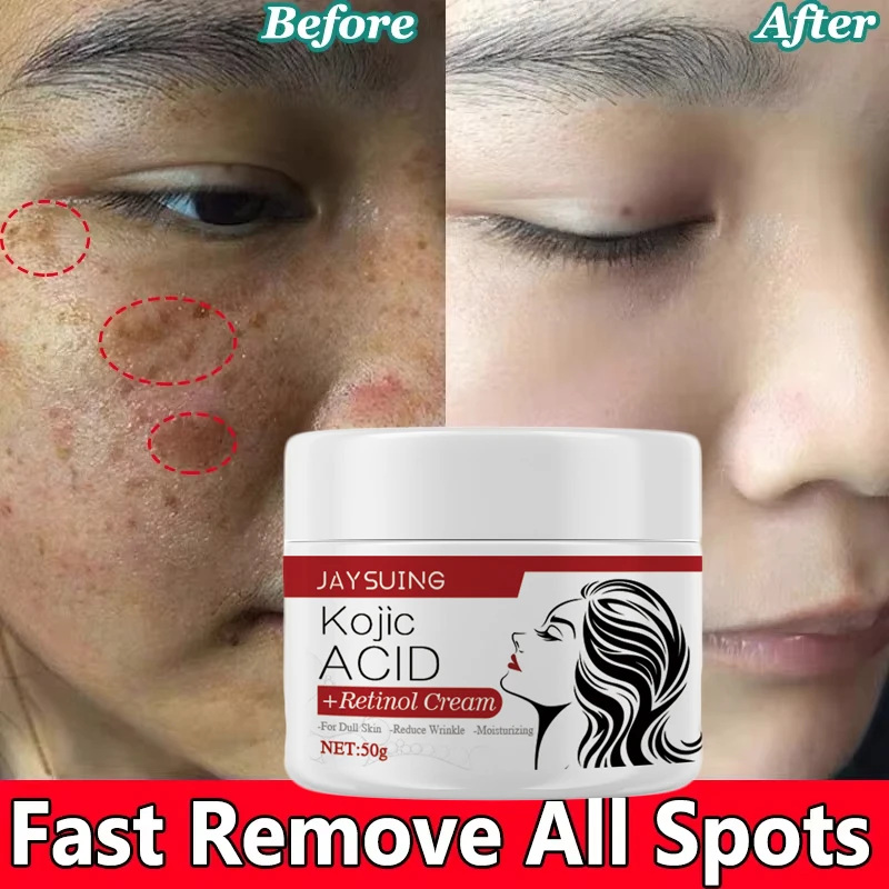 50G Face Whitening Cream Retinol Collagen Hyaluronic Acid 3in1 Remove Dark Spots Eliminate Melanin Anti-wrinkle Lighten The Skin