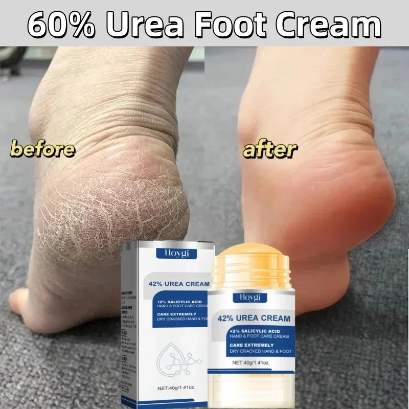 

60% Urea Foot Cream Aloe Vera Ultra-hydrating Softening Dry Cracked Feet Cream Gentle Exfoliation Daily Foot Care Solution 40g