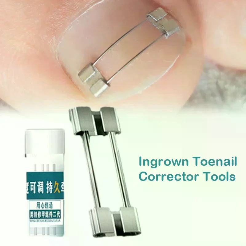 Ingrown Toenail Corrector Tools Pedicure Recover Embed Toe Nail Treatment Professional Straightening Clip Brace