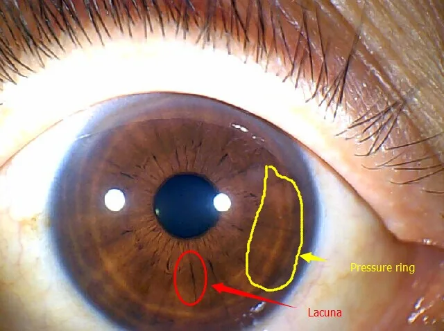 نظام Win10 مناسب لكاميرا Iidology للعين بدقة 12.00 ميجابكسل