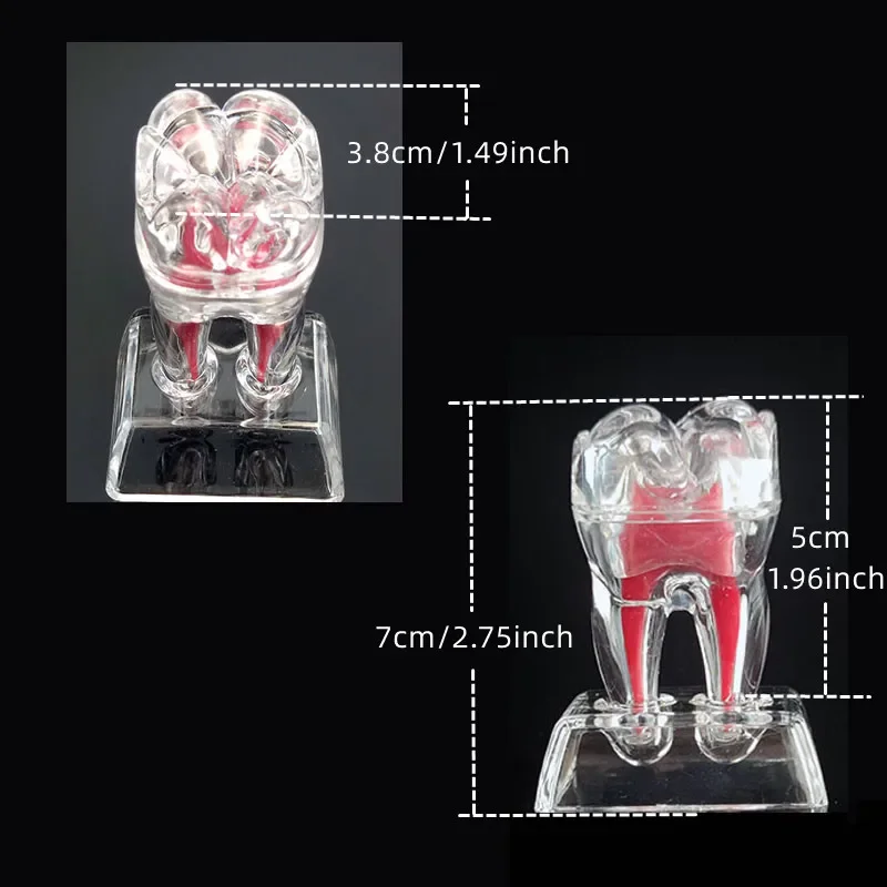 Stomatologiczny Model Anatomiczny Przezroczysty Świecący Odłączany Pojedynczy Ząb Rozkład Klinika Stomatologiczna Ozdoby 4xZęby 70mm