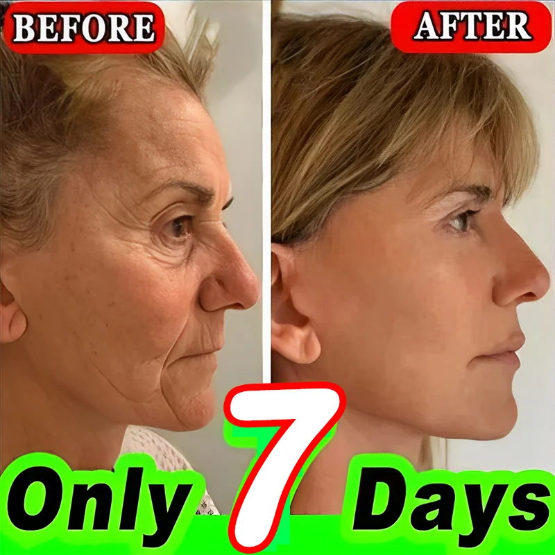 

anti-wrinkle oxys cream anti aging cream anti wrinkle cream beauty-health face lift facial massagers lighting
