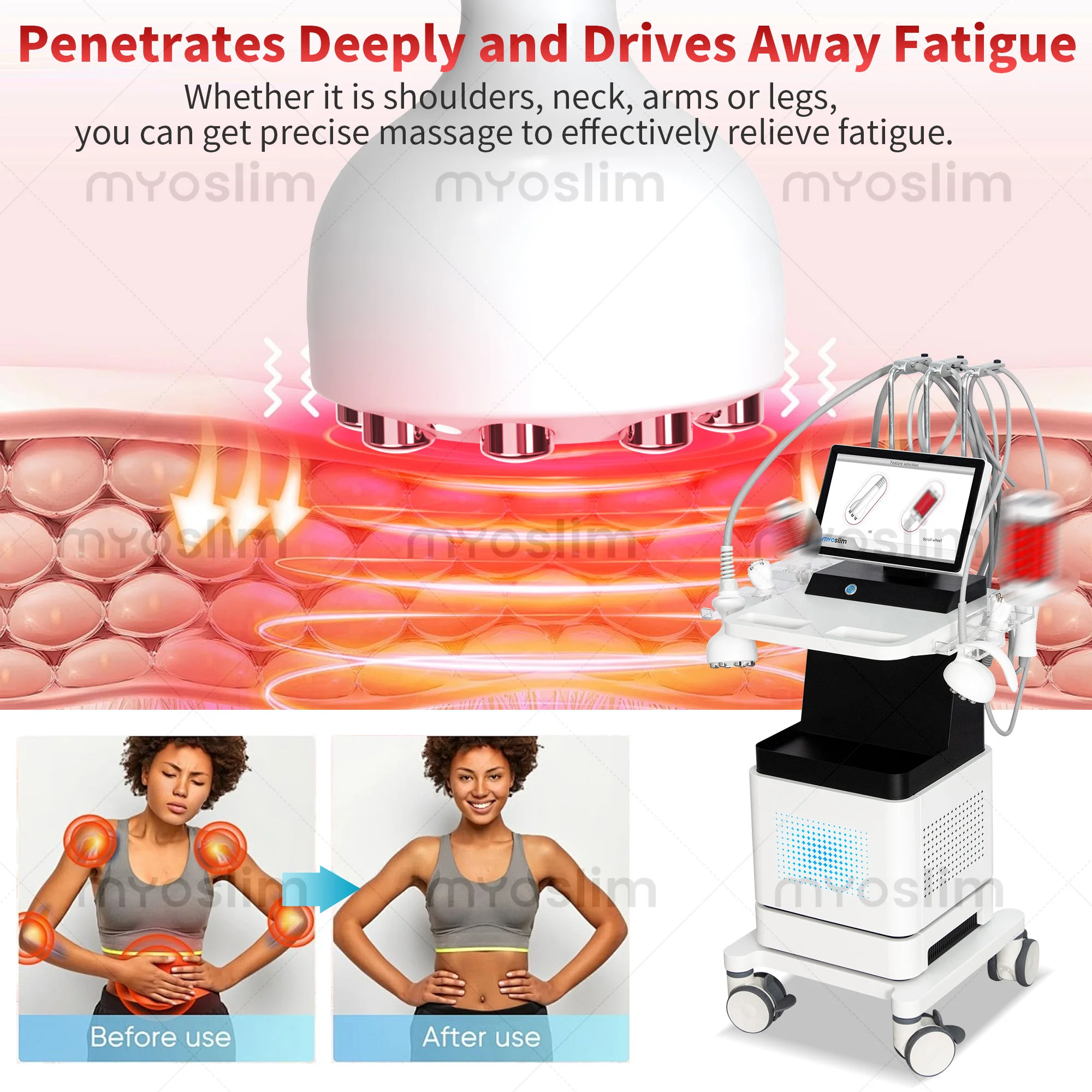 

Goddess Machine + Inner Ball Wheel RF Device for Firmening Skin, Reducing Wrinkles, and Lightening Prenatal Stretch Marks.