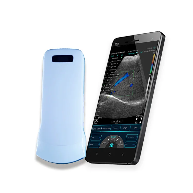 

Best & Newest Wireless Color Convex Probe 3.5/5mhz C10ct for Emergency Doctor