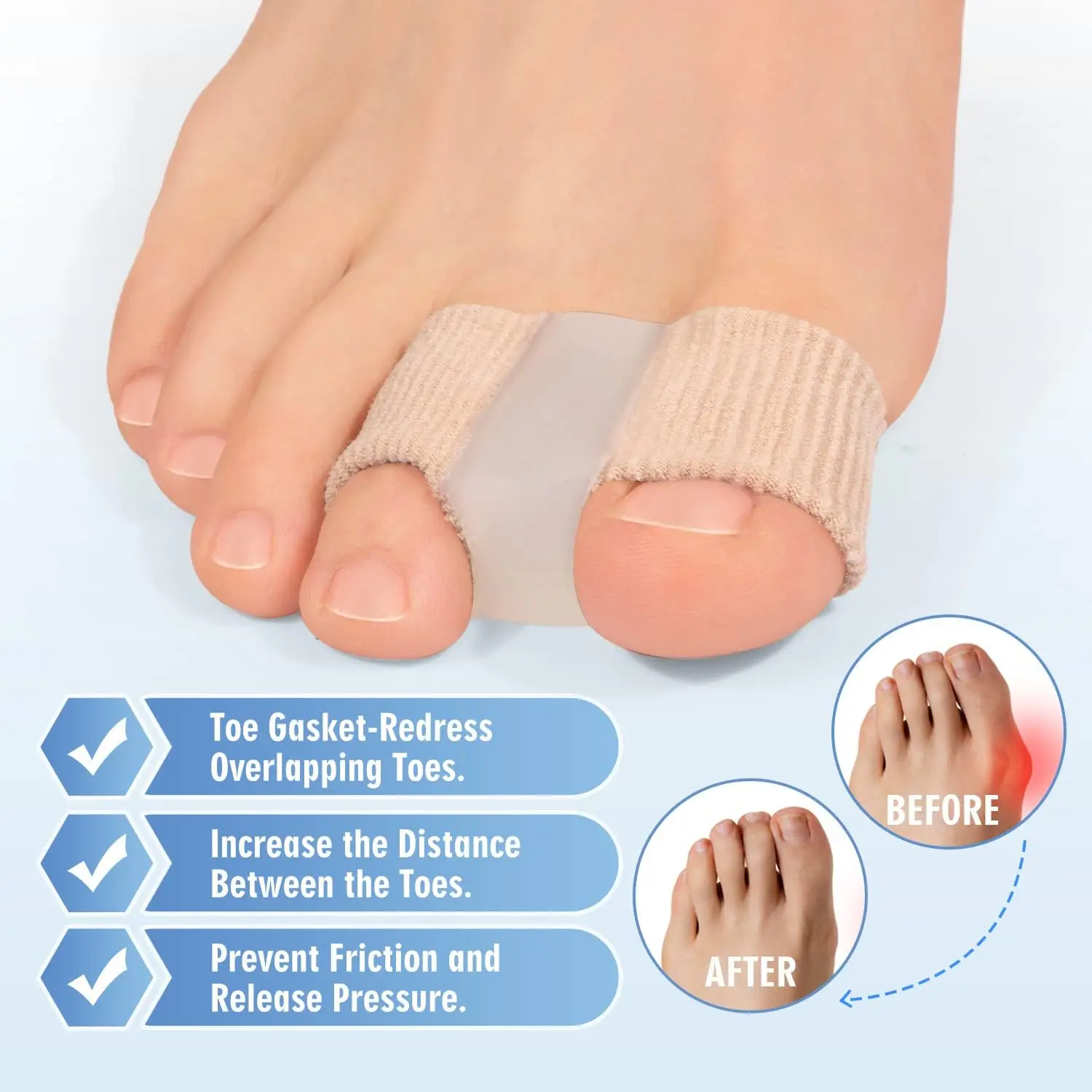 2Pcs Two Holes Toe Separator Hallux Valgus Bunion Corrector Orthotics Thumb Straightener Feet Bone Adjuster Pedicure Foot Care