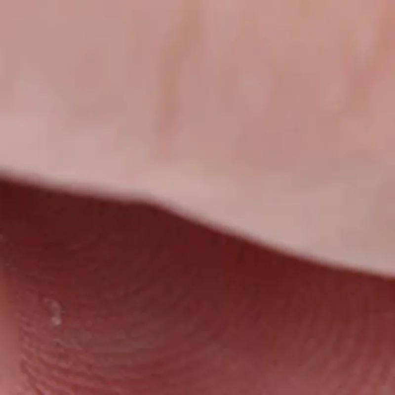 

10Pcs Adjustable Male External Catheter Strap Fixed Urine Bag Men Urinary Incontinence Penile Clamp Fixer Reusable Holder Band