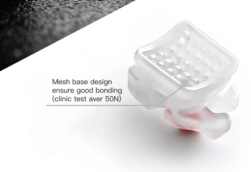 AZDENT Dental-Brackets, kieferorthopädische Zahnspangen, selbstligierend, aus Keramik, transparent, Roth/MBT 0,022, Haken 3-4-5 mit Öffnungswerkzeug, 20 Stück – Detail 6