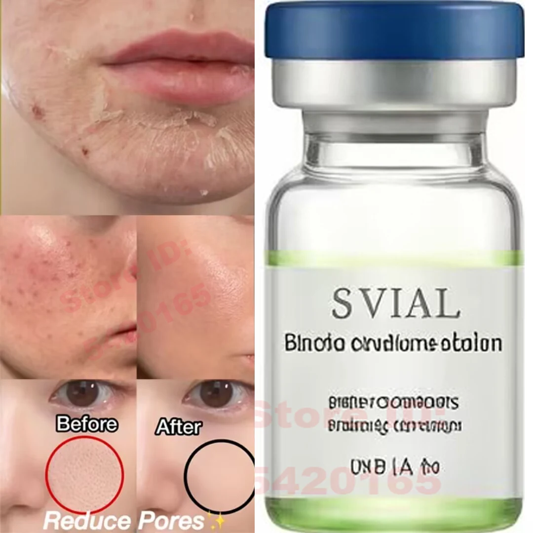Powerfu Korea Bio Peeling Solution Ampoule Skin Booster Shrink Pores Rejuvenation Acne Scar Repair Fine Lines Moisturizing 6ML