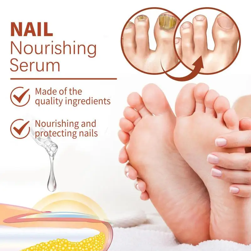 Natural Nail Strengthener Nail Repair Nail Care Essence Providing Rich Nutrition And Aiding In Nail Repair Nail Care Product For