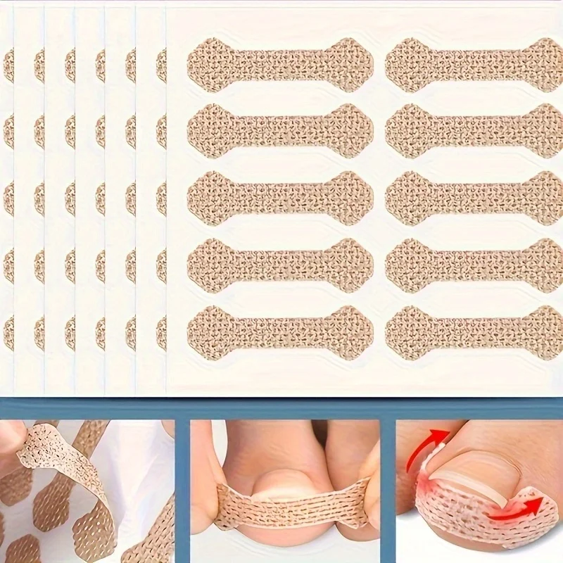 Wholesale Ingrown Paronychia Anti F Toenail Strips Corrector 10pcs Ingrown Paronychia Toenail Corrector Strips Anti F