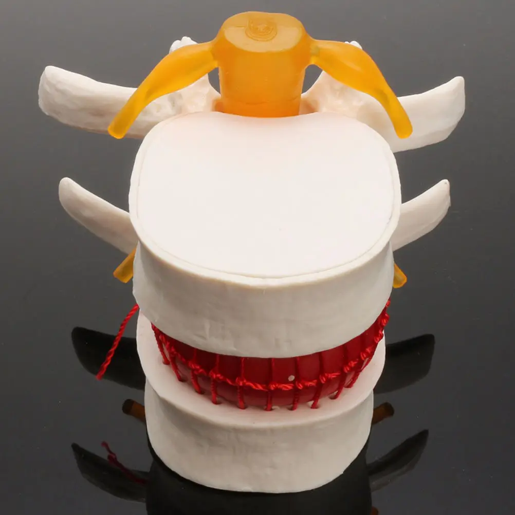 

1Pcs Human Spine Lumbar Anatomy PVC Durable Practice Teaching Display for Medical Student Doctor Nurse Spine for Teaching