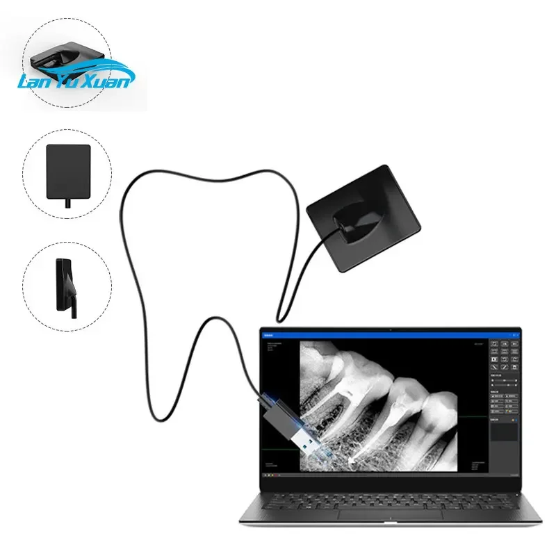 Hot Sale Teeth Equipment Usb Teeth Sensor Positioner Digital Intra-Oral Sensor X Ray Teeth Sensor