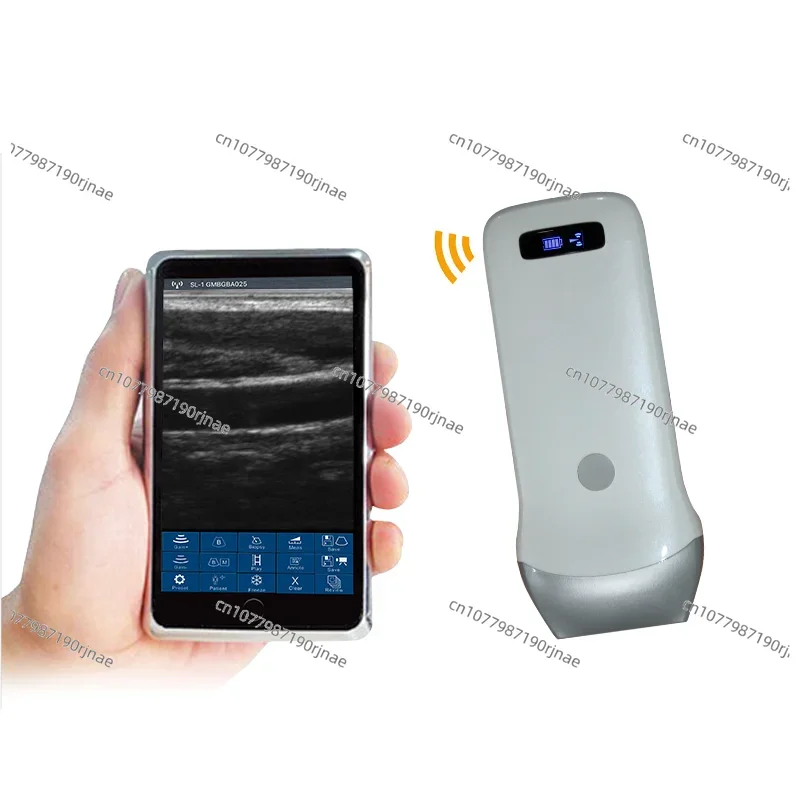 

Medical Devise Mini Portable Wireless Handheld Convex Linear Probe Ultrasound Scanner