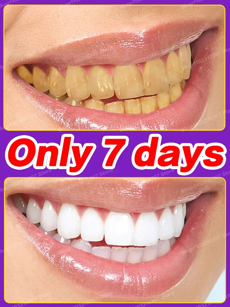 

Teeth whitening Tooth Cleaning Improve Tartar Oral care