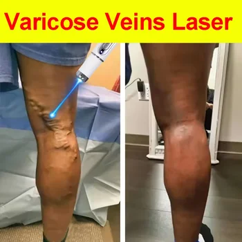 10 best sales वैरिकाज़ - №1