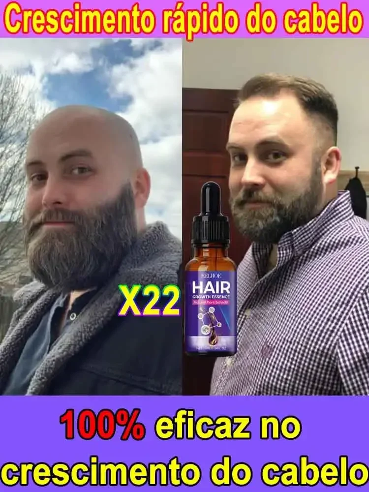 

99% of buyers buy again, have more and more hair, say goodbye to baldness, thick hair,Hot selling product