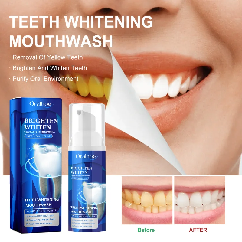 

Teeth Whitening Cleaning Mousse-Remove Yellow Stains, Tartar & Dirt, Beautify Teeth, Freshen Breath, Oral Care For Dental Health