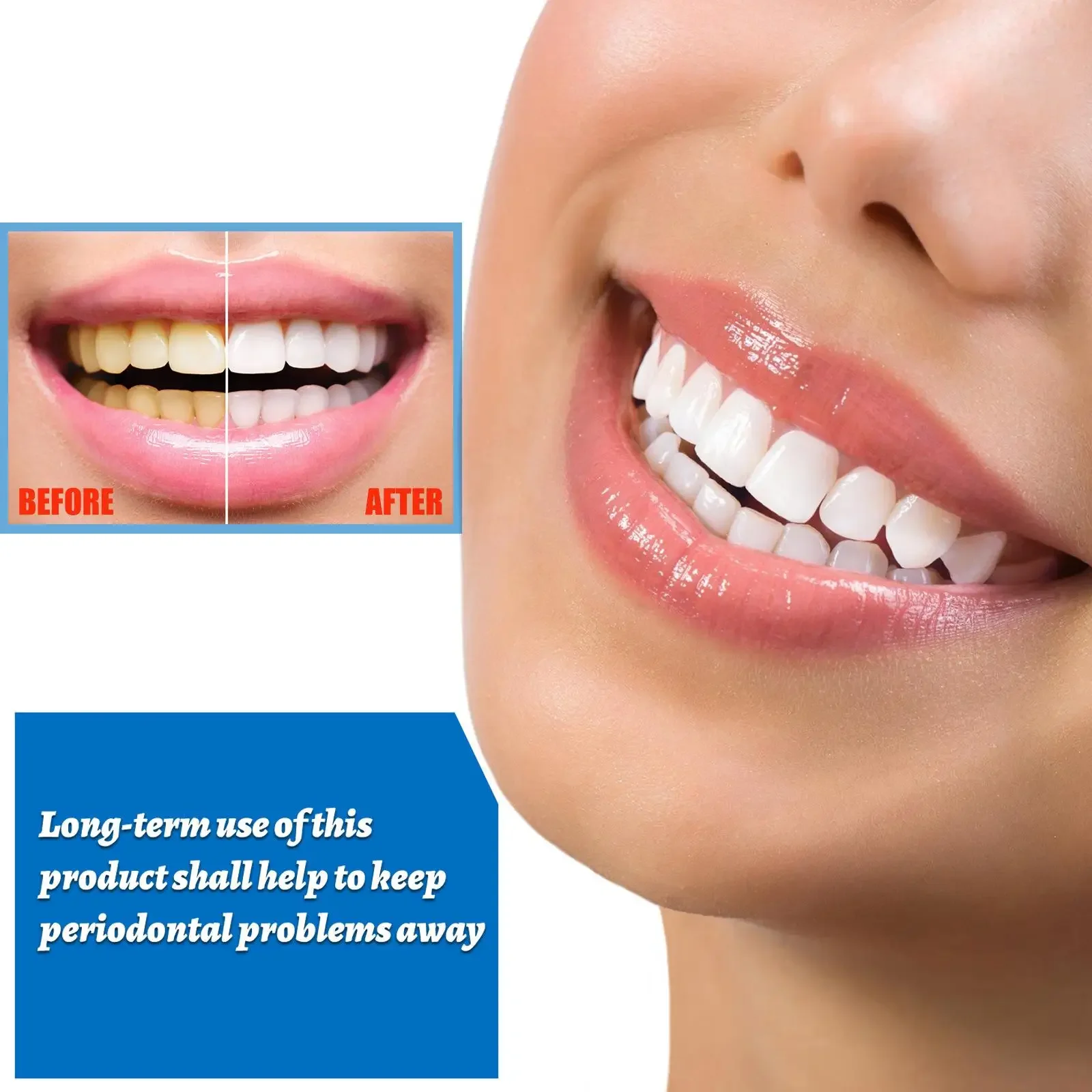 Teeth Cleaning Deep Removing Tartar Stains