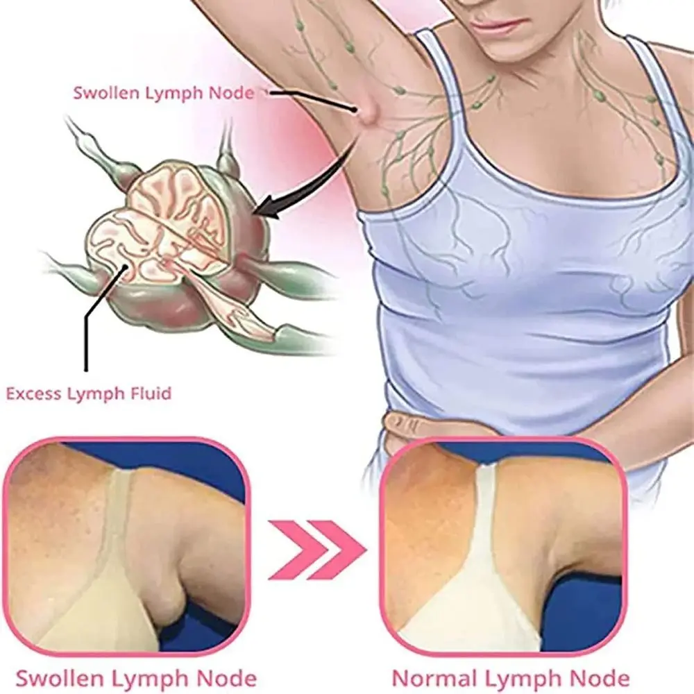 لتخفيف الوزن أقراط العلاج المغناطيسي اللمفاوي أقراط الوخز بالإبر أقراط العلاج المغناطيسي أقراط الجرمانيوم للنساء #3