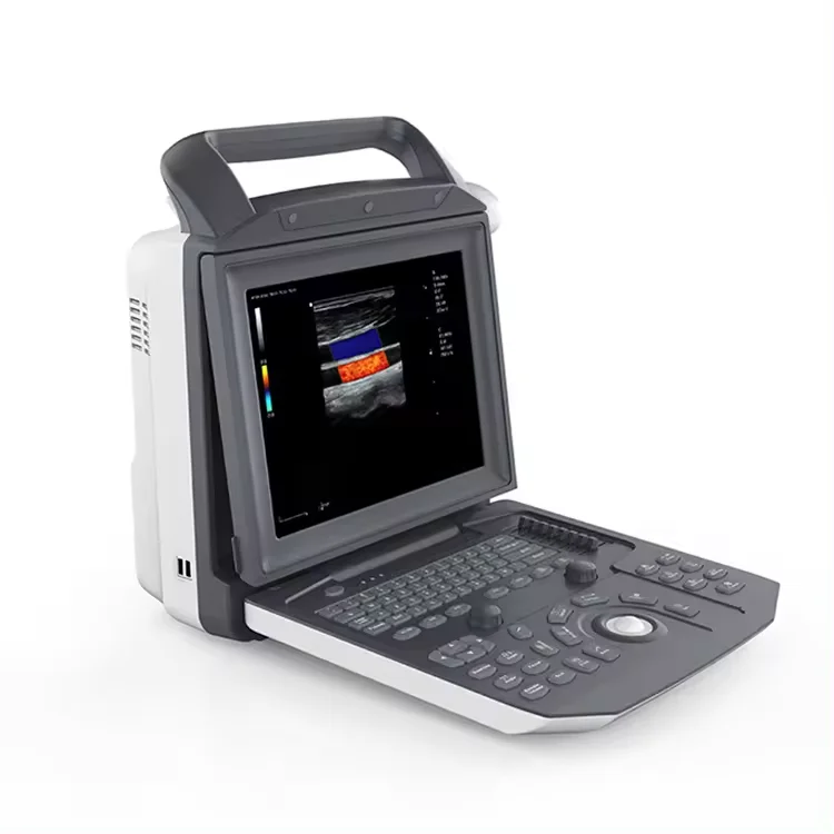 4D   Laptop  Portable Medical  Ecografo Zoncare M5 System 3D ry Ce Unilever