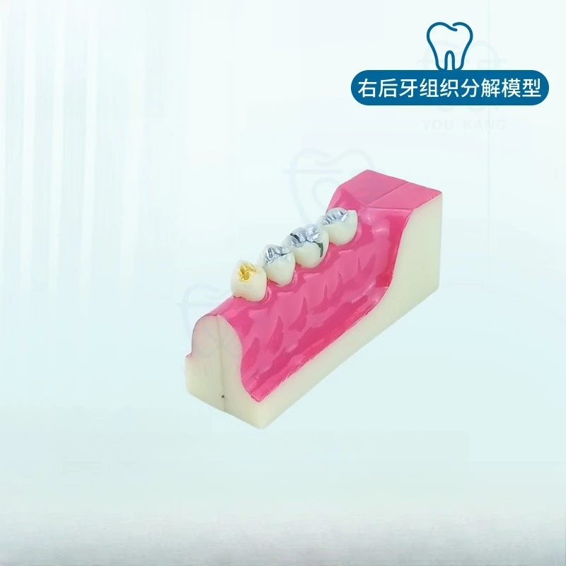 Right posterior tooth tissue decomposition tooth model decomposition oral display standard doctor-patient communication