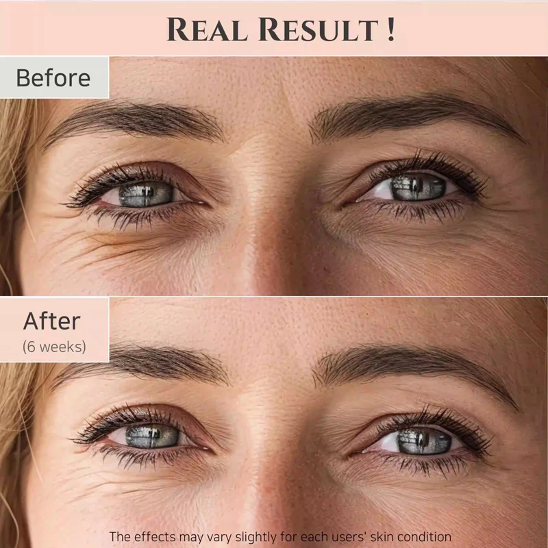 كوريا الجمال من جوسون مصل العين الجينسنغ كريم عين ثبات المضادة للتجاعيد ترطيب تقليل الخطوط الدقيقة تحسين الهالات السوداء