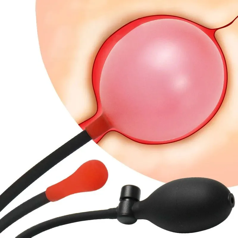 المكونات الشرج نفخ للمبتدئين ، وسهلة لإدراج ، مضخة بعقب صغيرة قابلة للتوسيع ، لعبة الجنس للرجال والنساء #1
