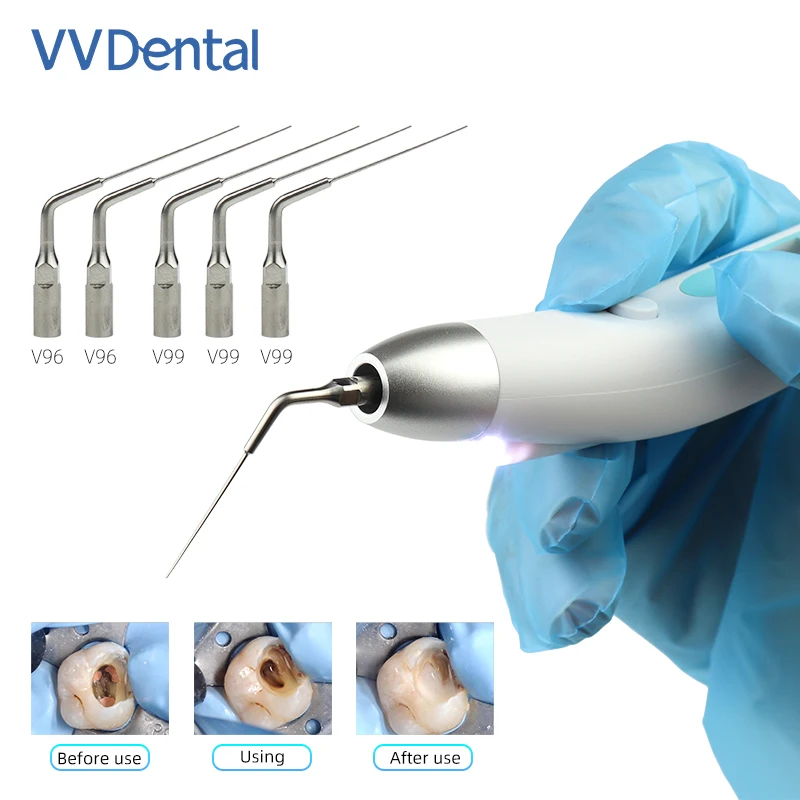 

VV Dental Endodontic Motor Sonic Endo Irrigator Ultrasonic with LED Tips for Endodontics Root Canal Calcified Material Dentistry