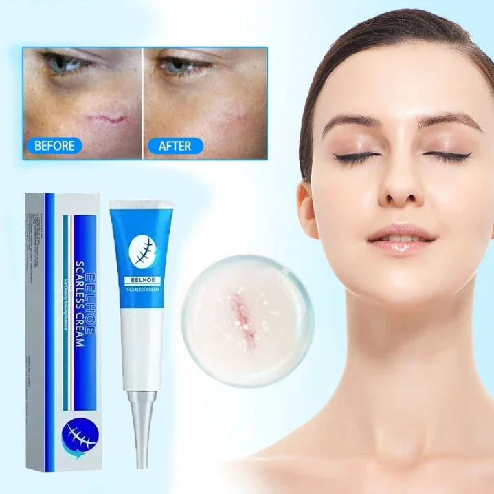 

Women's Beauty And Scar Removal Keeps The Face Moisturized And Repairs Damaged Skin Scar Postoperative scar repair