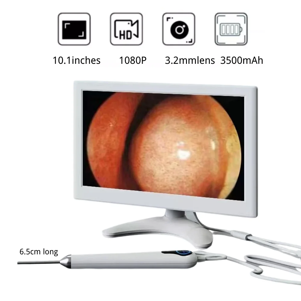 Visible Light Ear Spoon 10.1 inch Large Screen HD 3.2mm Thin Lens Ear Cleaner Tools with 6LEDs Endoscope Ear 3500mAh