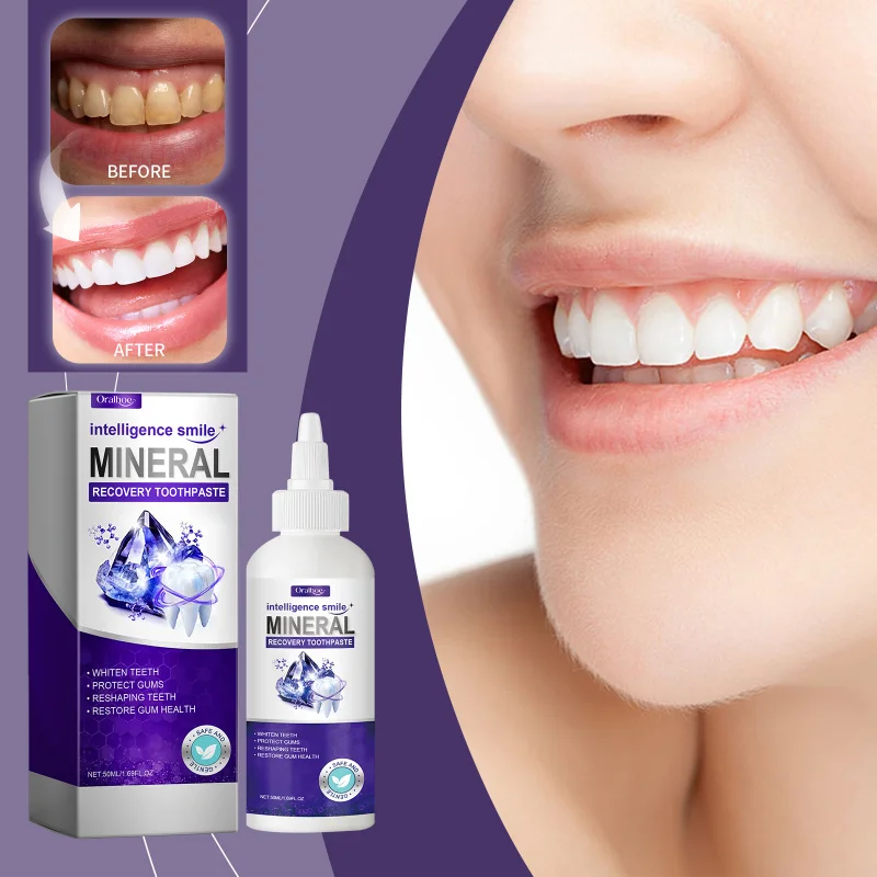 

Teeth Care Toothpaste - Clean Teeth Hygiene Protect Oral Daily Fresh Care Toothpaste for Deposit Reduction Daily Oral Care