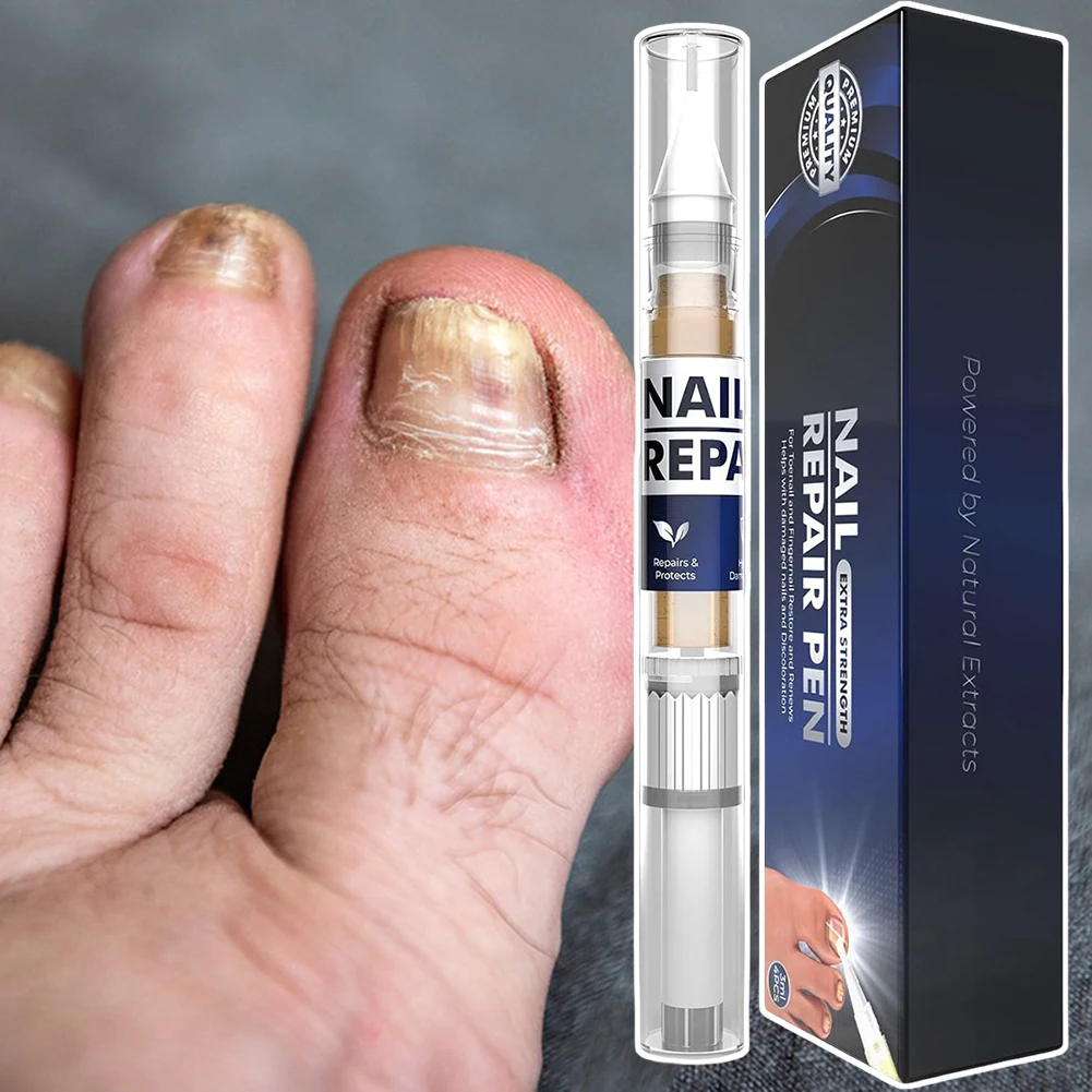 Soluzione per la riparazione delle unghie per danni alle unghie Liquido naturale efficace per la riparazione di funghi delle unghie per l'unghia del piede per la cura quotidiana delle unghie Routine