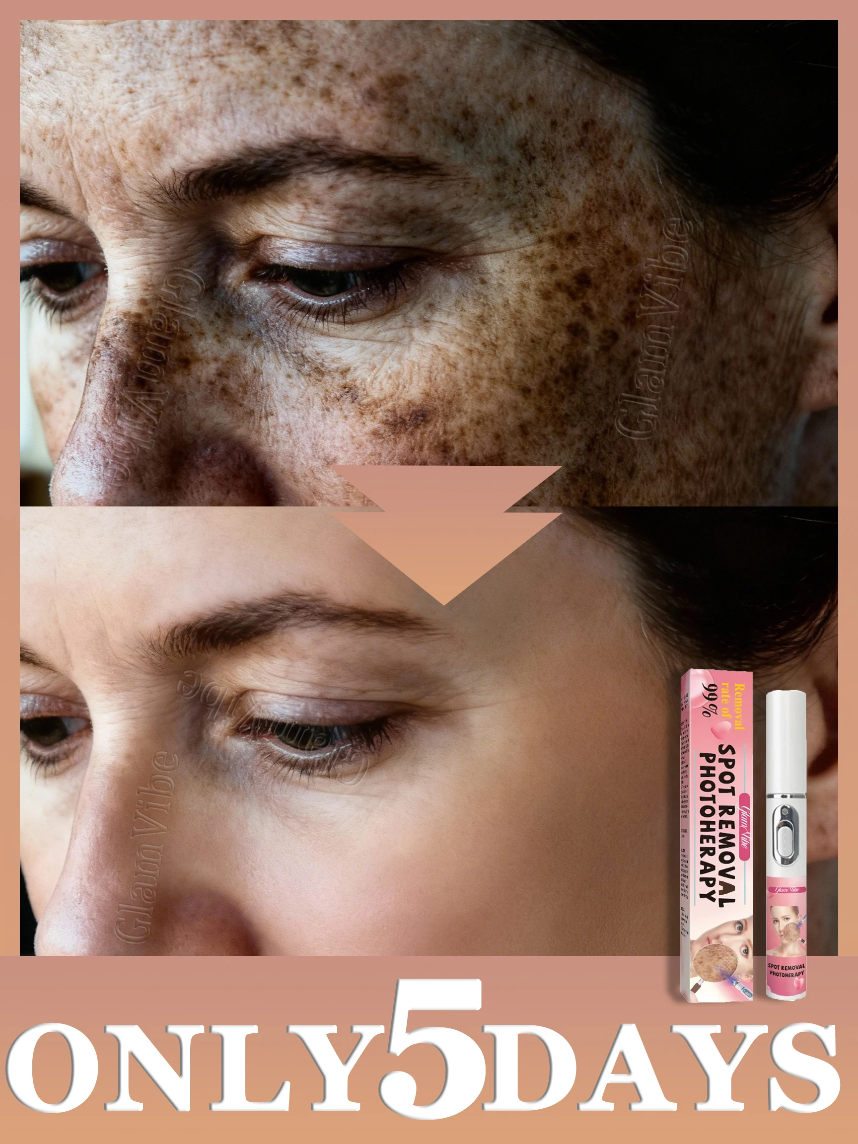 

Улучшает состояние грубой кожи, удаляет веснушки, возрастные пятна и несовершенства; подходит для применения на всем лице.