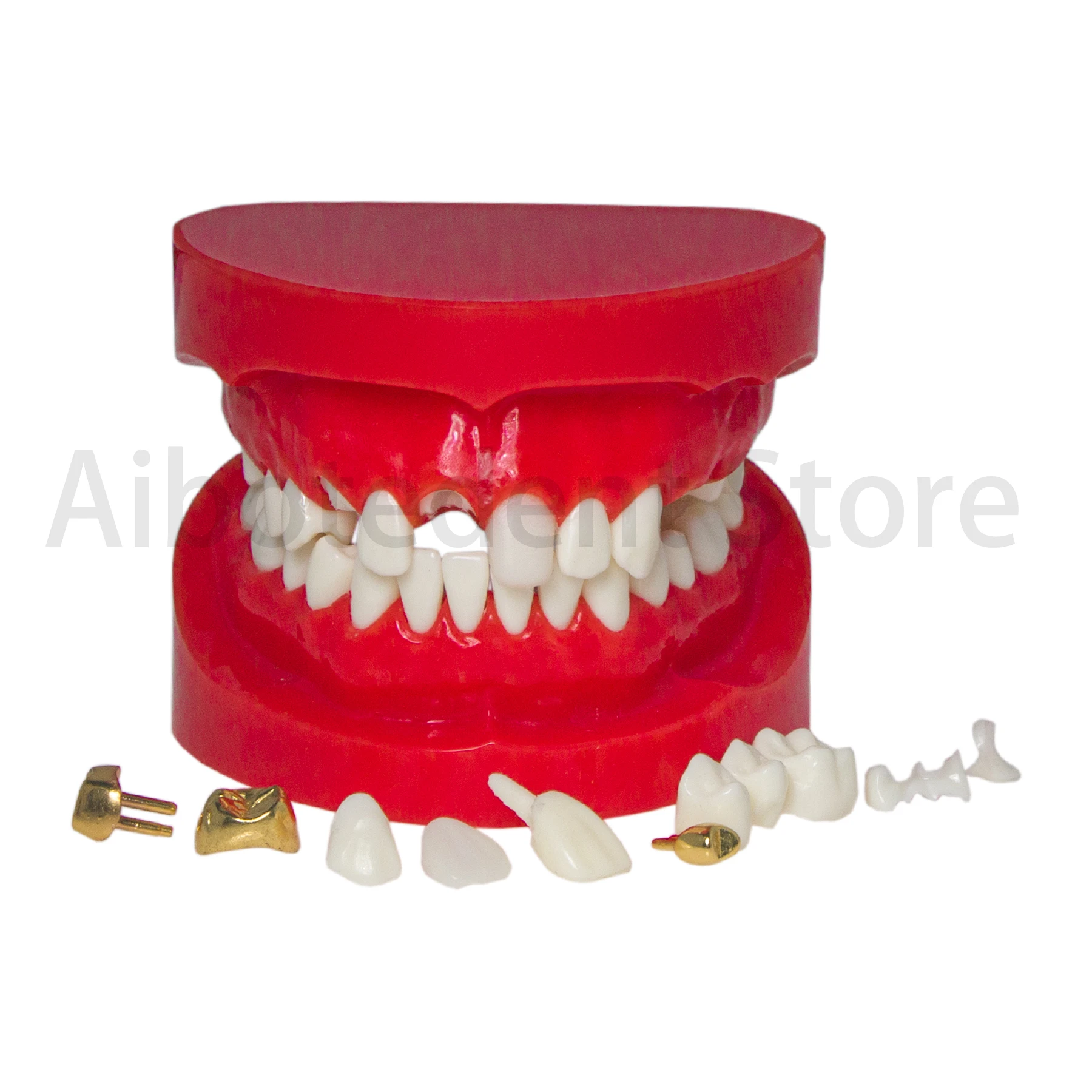 Dental Teeth Model Crown Restoration Model Typodont Teeth with Post Core Bridge for Teaching M6004